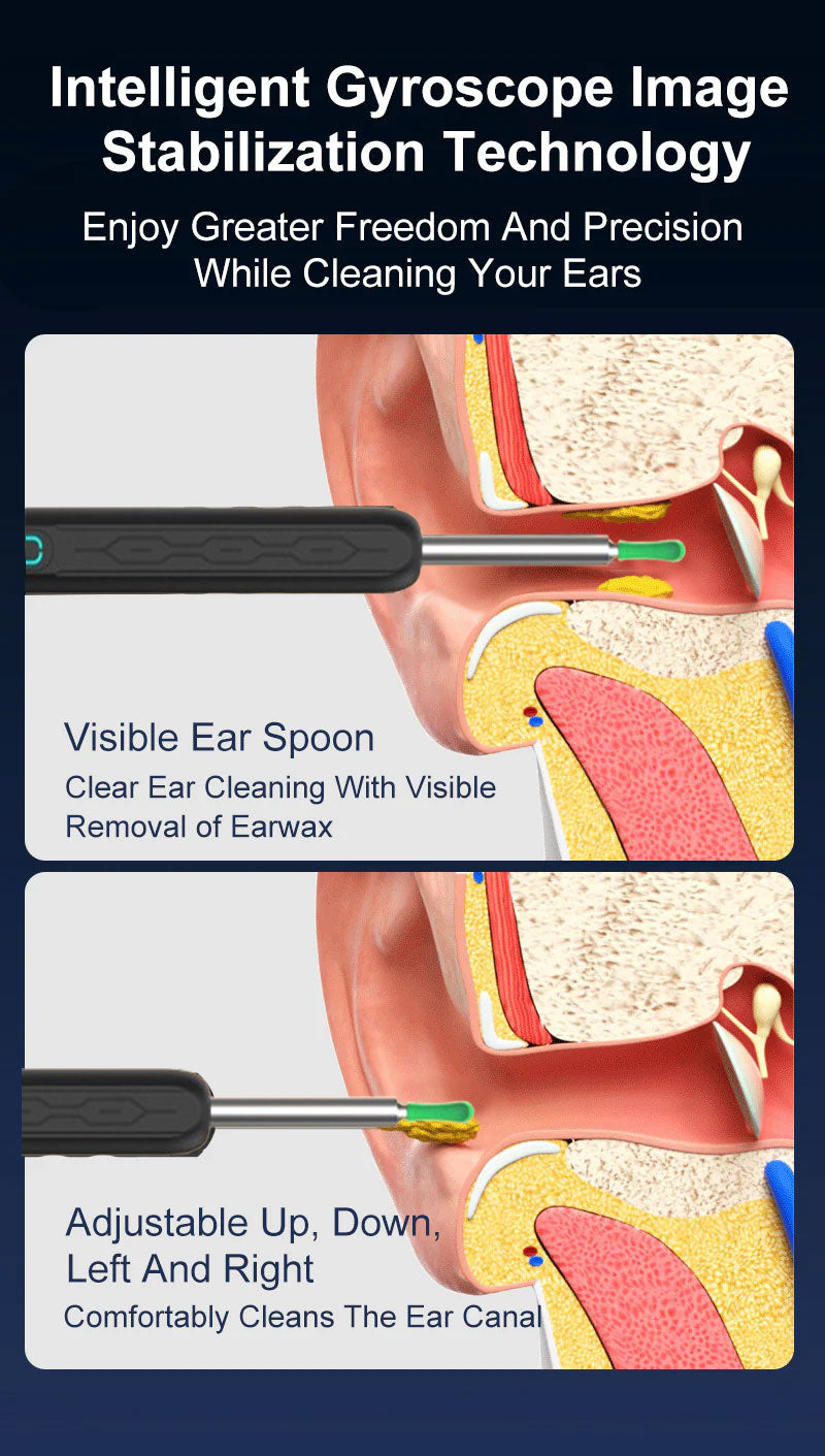 Smart vanntett visuell ørevoksfjerner