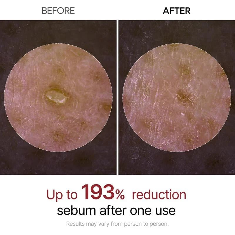 🏆Flash Sale⚡ 50K+ SOLGT! Nesten utsolgt-💥🔥Rice Ampoule Duo